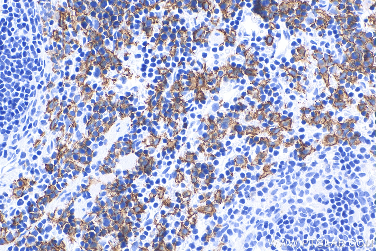 Immunohistochemistry (IHC) staining of mouse spleen tissue using F4/80 Polyclonal antibody (29414-1-AP)