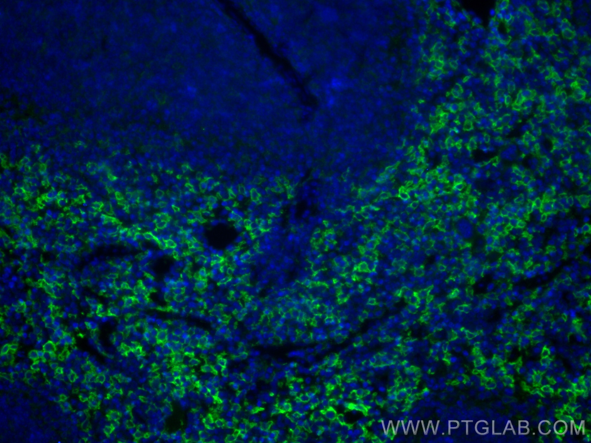 Immunofluorescence (IF) / fluorescent staining of mouse spleen tissue using mouse F4/80 Recombinant antibody (81668-1-RR)