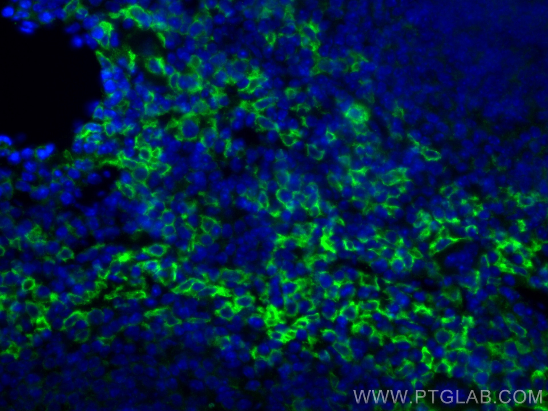 IF Staining of mouse spleen using 81668-1-RR