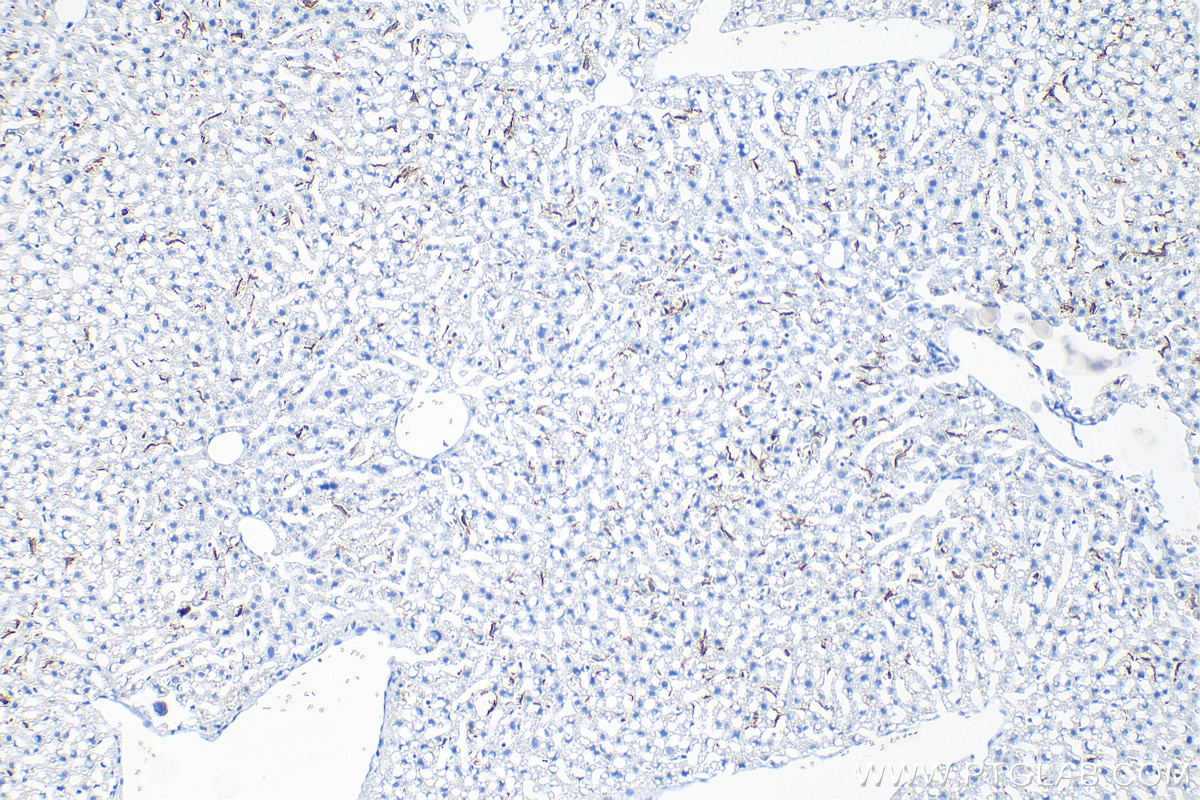 Immunohistochemistry (IHC) staining of mouse liver tissue using mouse F4/80 Recombinant antibody (81668-1-RR)