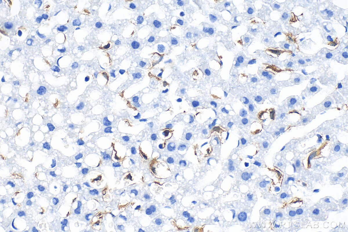 Immunohistochemistry (IHC) staining of mouse liver tissue using F4/80 Recombinant antibody (81668-1-RR)