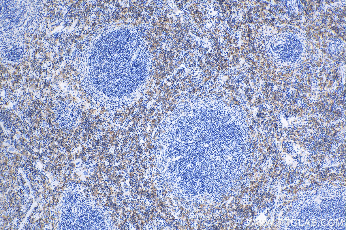 IHC staining of mouse spleen using 81668-1-RR