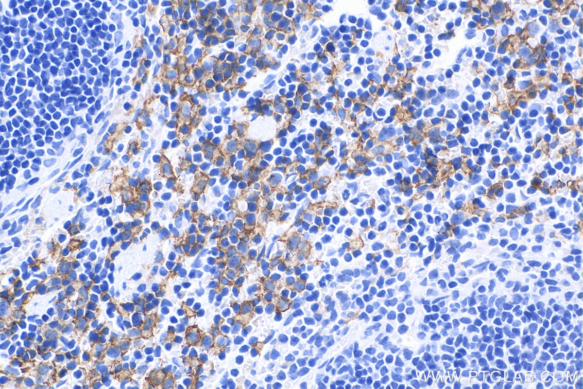IHC staining of mouse spleen using 81668-1-RR