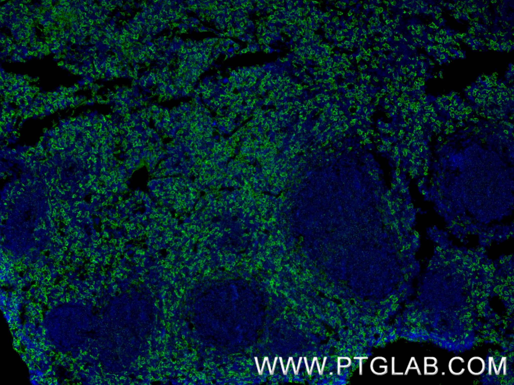 Immunofluorescence (IF) / fluorescent staining of mouse spleen tissue using F4/80 Recombinant antibody (84538-1-RR)