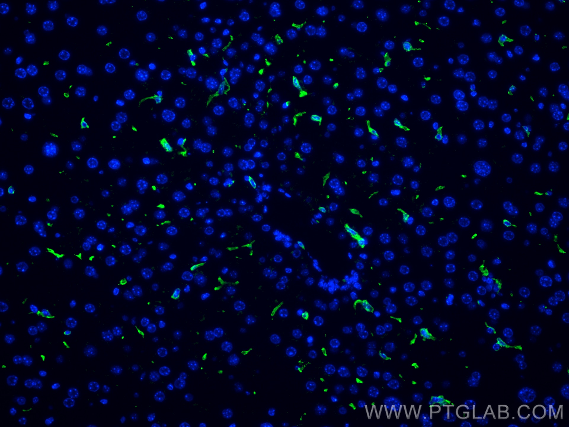 Immunofluorescence (IF) / fluorescent staining of mouse liver tissue using F4/80 Recombinant antibody (84538-1-RR)