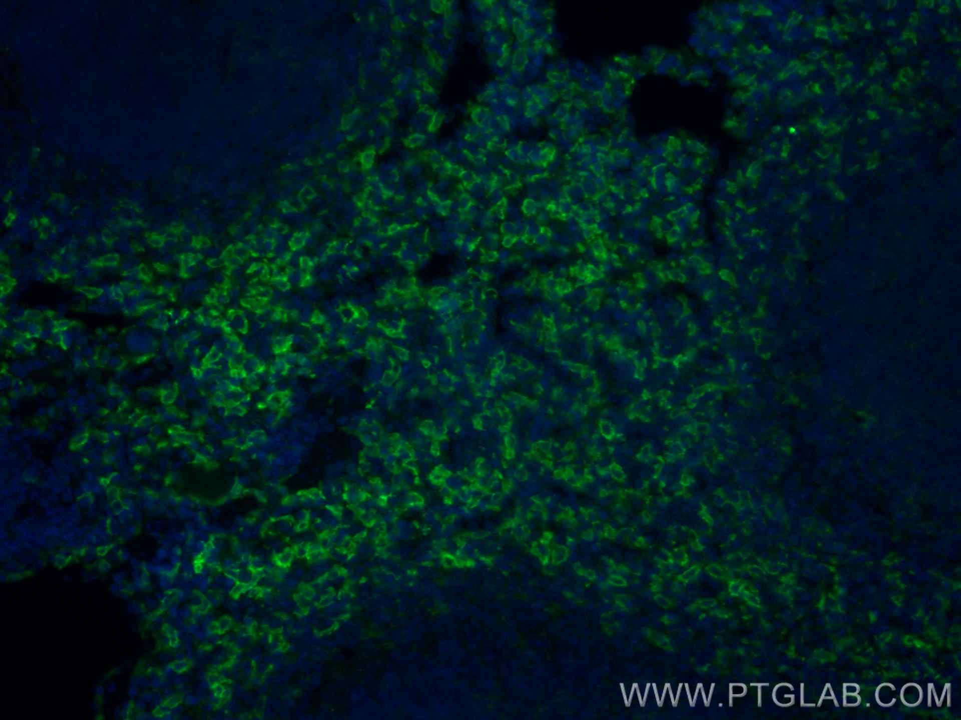Immunofluorescence (IF) / fluorescent staining of mouse spleen tissue using CoraLite® Plus 488-conjugated F4/80 Polyclonal ant (CL488-28463)