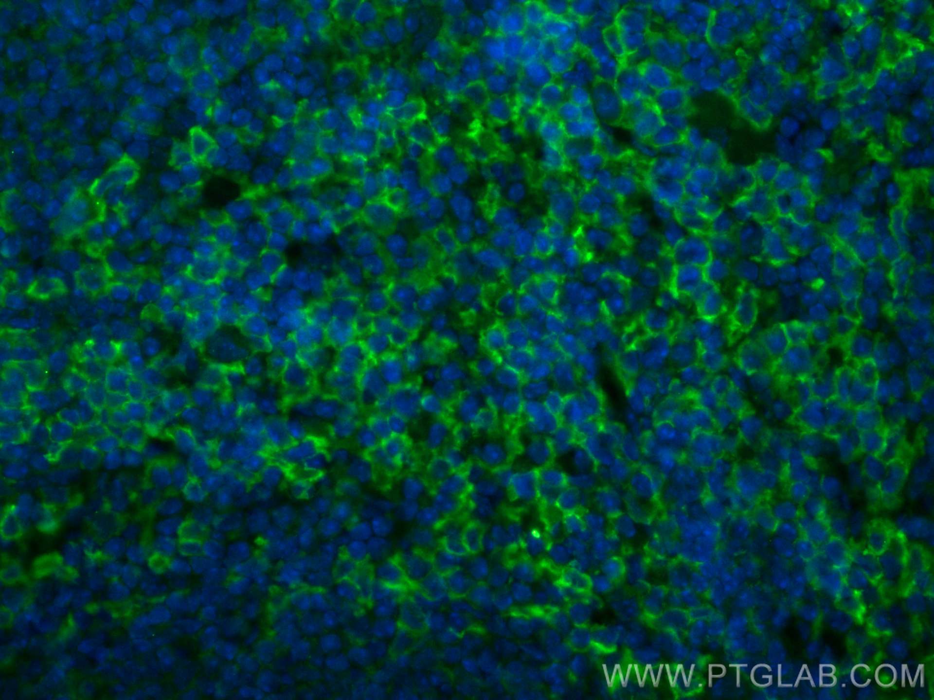 Immunofluorescence (IF) / fluorescent staining of mouse spleen tissue using CoraLite® Plus 488-conjugated F4/80 Polyclonal ant (CL488-28463)