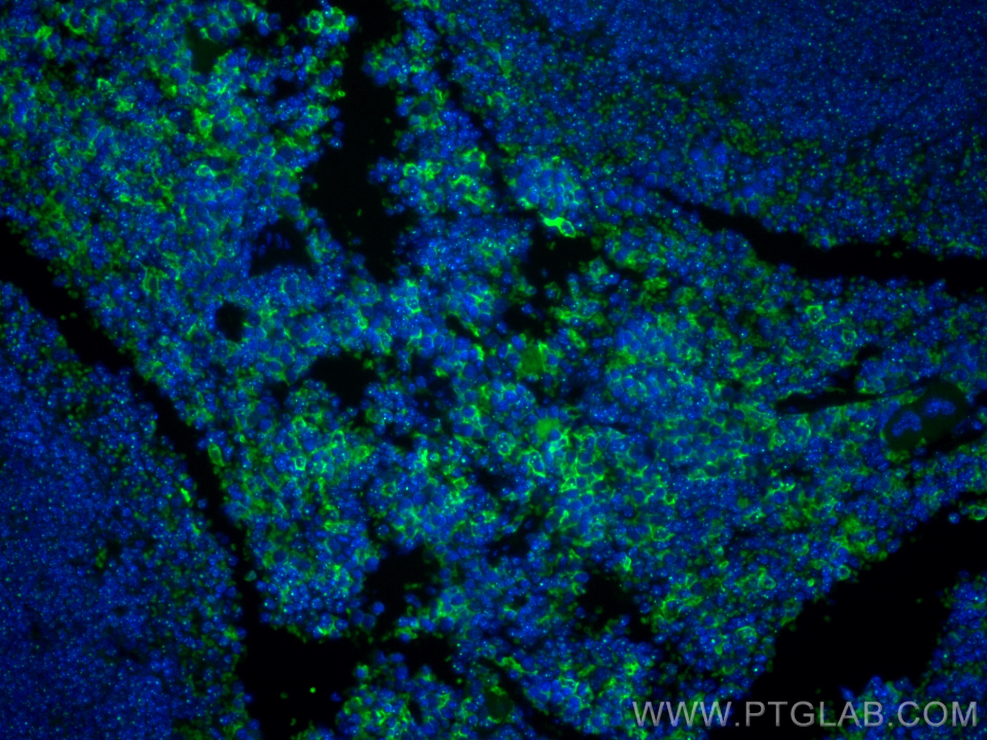 Immunofluorescence (IF) / fluorescent staining of mouse spleen tissue using CoraLite® Plus 488-conjugated F4/80 Recombinant an (CL488-84538)