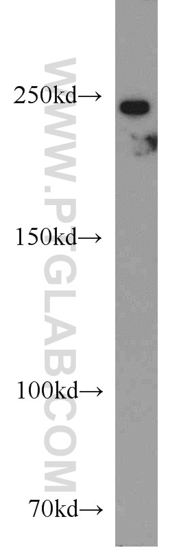 Western Blot (WB) analysis of mouse liver tissue using F5 Polyclonal antibody (20963-1-AP)