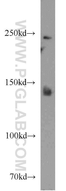 Western Blot (WB) analysis of mouse liver tissue using F5 Polyclonal antibody (20963-1-AP)
