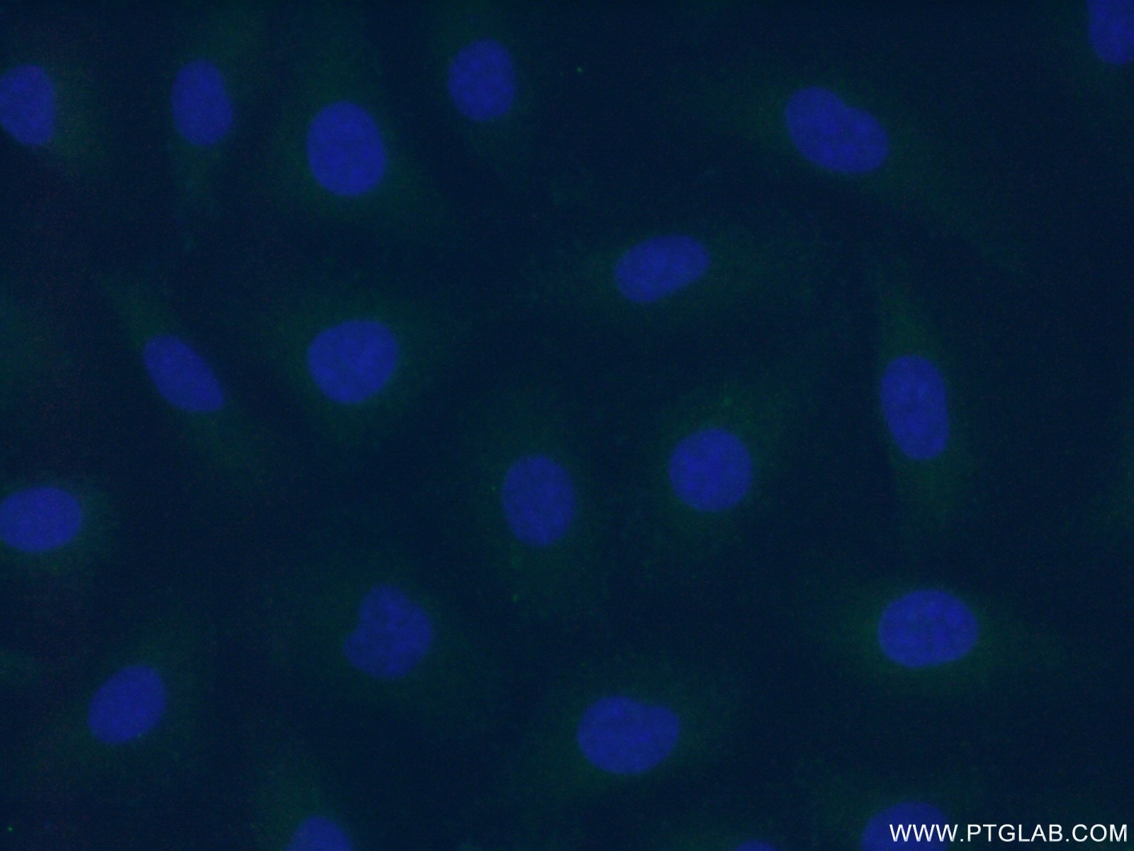 Immunofluorescence (IF) / fluorescent staining of HUVEC cells using F7 Polyclonal antibody (23058-1-AP)