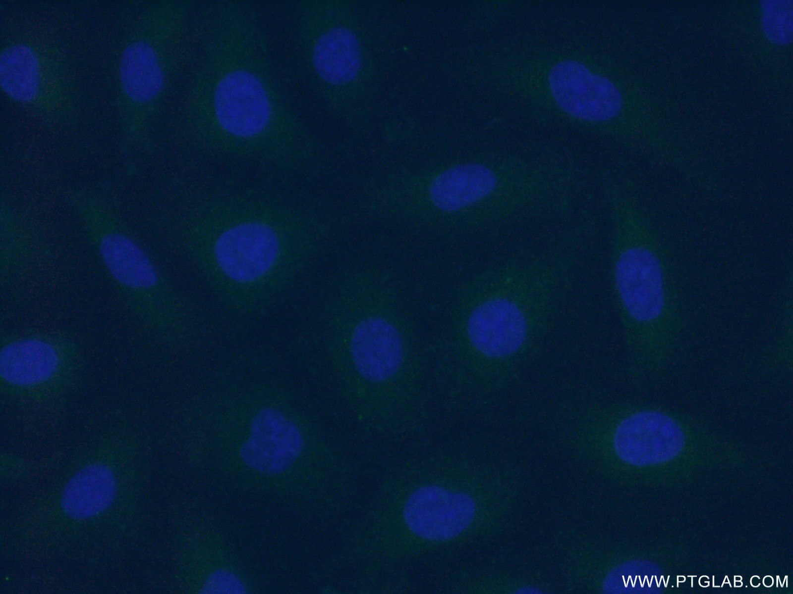 Immunofluorescence (IF) / fluorescent staining of HUVEC cells using F7 Polyclonal antibody (23058-1-AP)