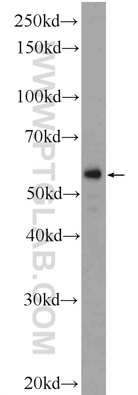 Western Blot (WB) analysis of human placenta tissue using F7 Polyclonal antibody (23058-1-AP)