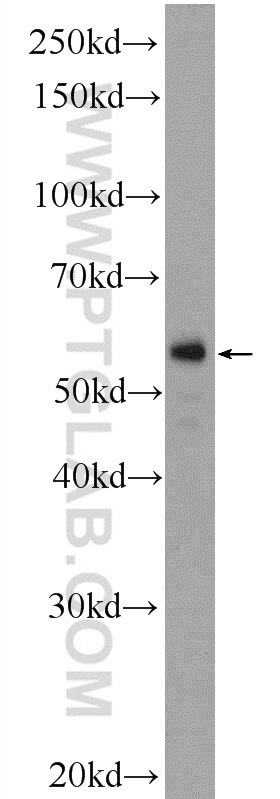 Western Blot (WB) analysis of human placenta tissue using F7 Polyclonal antibody (23058-1-AP)