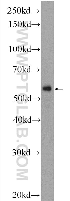 Western Blot (WB) analysis of human placenta tissue using F7 Polyclonal antibody (23058-1-AP)