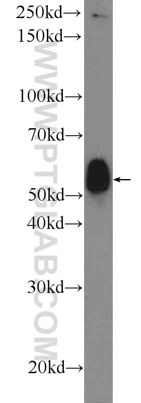 Western Blot (WB) analysis of human plasma using F7 Polyclonal antibody (23058-1-AP)