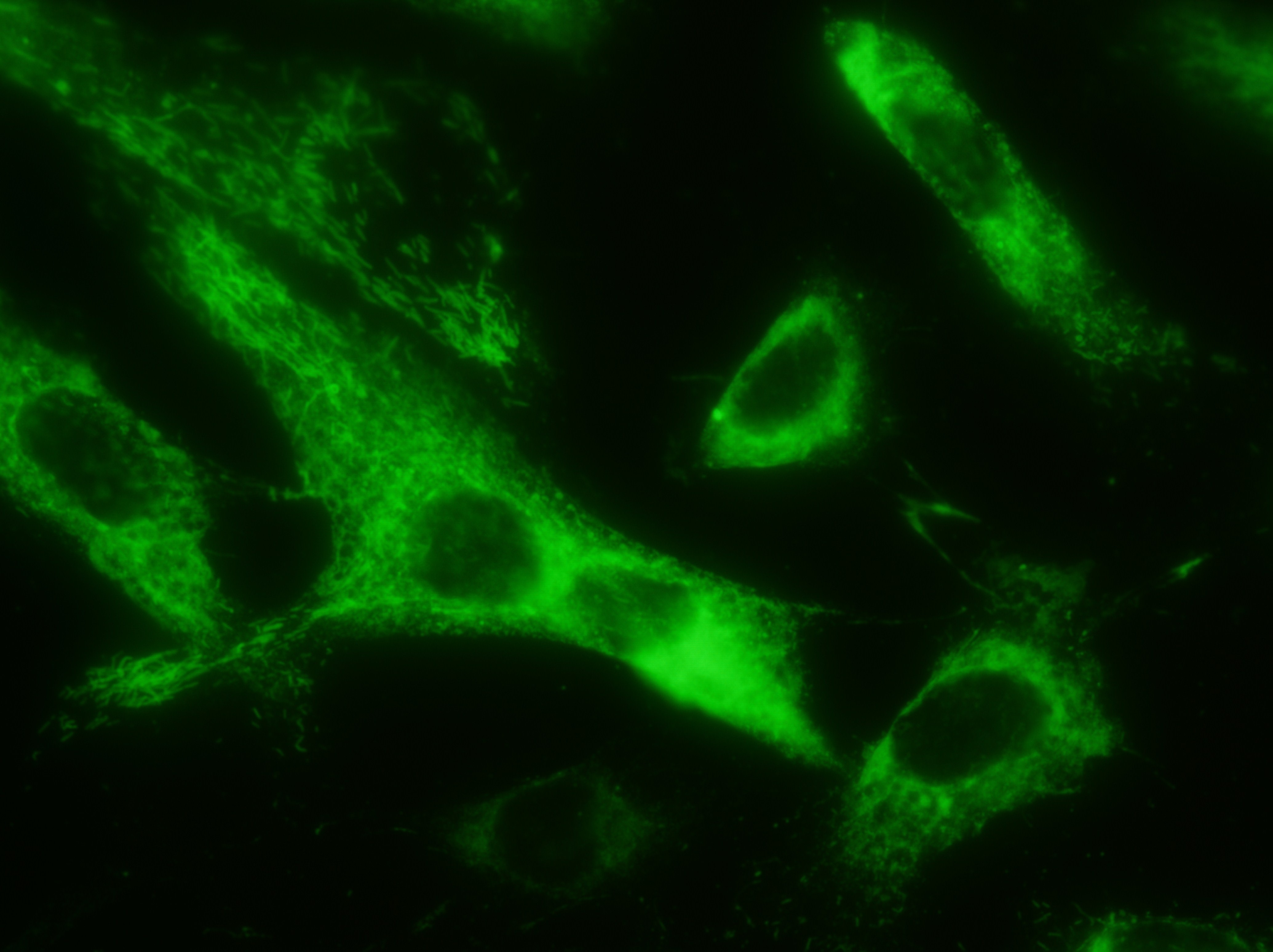 Immunofluorescence (IF) / fluorescent staining of human umbilical vein endothelial cells using F8 Polyclonal antibody (21485-1-AP)