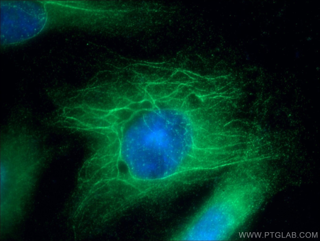 Immunofluorescence (IF) / fluorescent staining of HUVEC cells using F8 Polyclonal antibody (21485-1-AP)