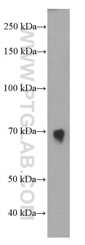 Western Blot (WB) analysis of human blood using F8 Monoclonal antibody (66722-1-Ig)