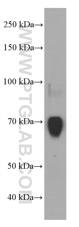 WB analysis of human plasma using 66722-1-Ig