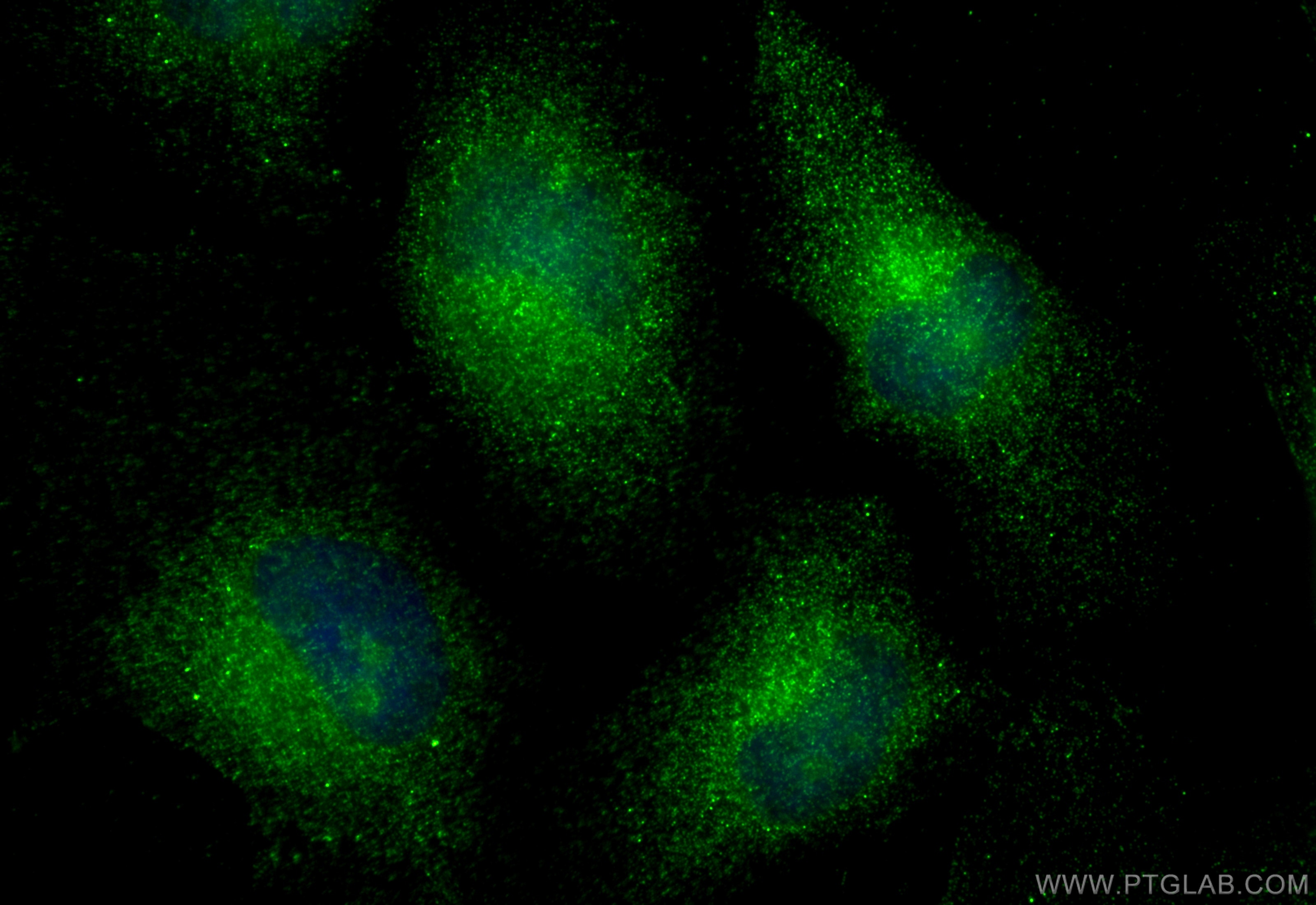 Immunofluorescence (IF) / fluorescent staining of HeLa cells using F8A2 Polyclonal antibody (32696-1-AP)