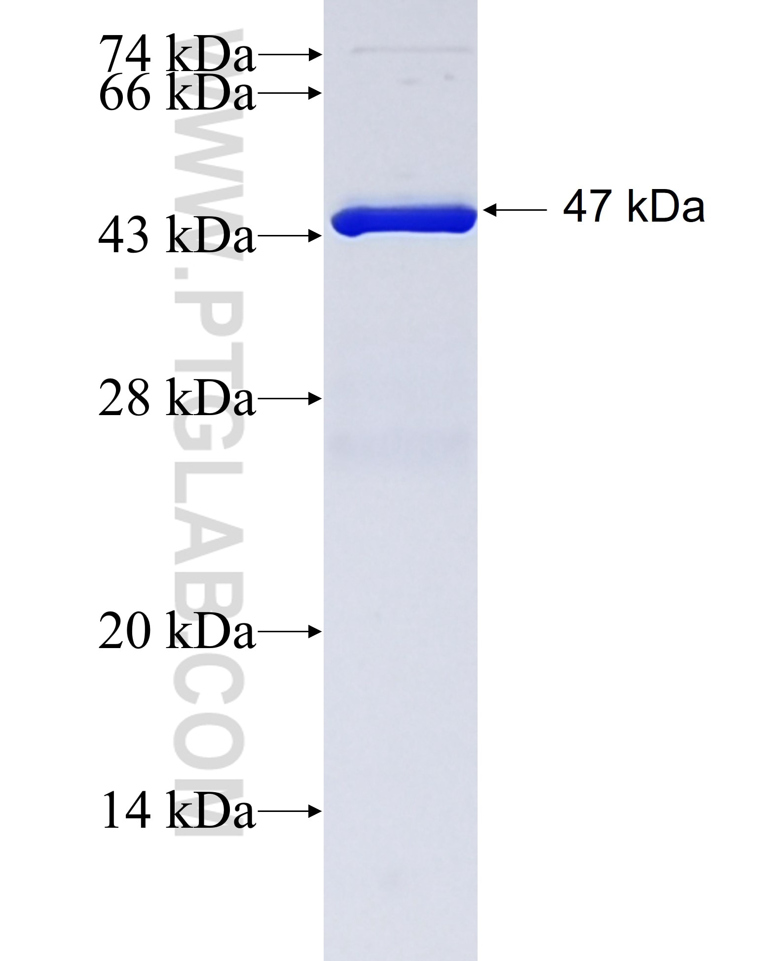 F8A2 fusion protein Ag38529 SDS-PAGE F8A2 fusion protein Ag38529 SDS-PAGE