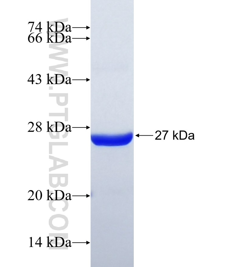 F8A2 fusion protein Ag38877 SDS-PAGE F8A2 fusion protein Ag38877 SDS-PAGE
