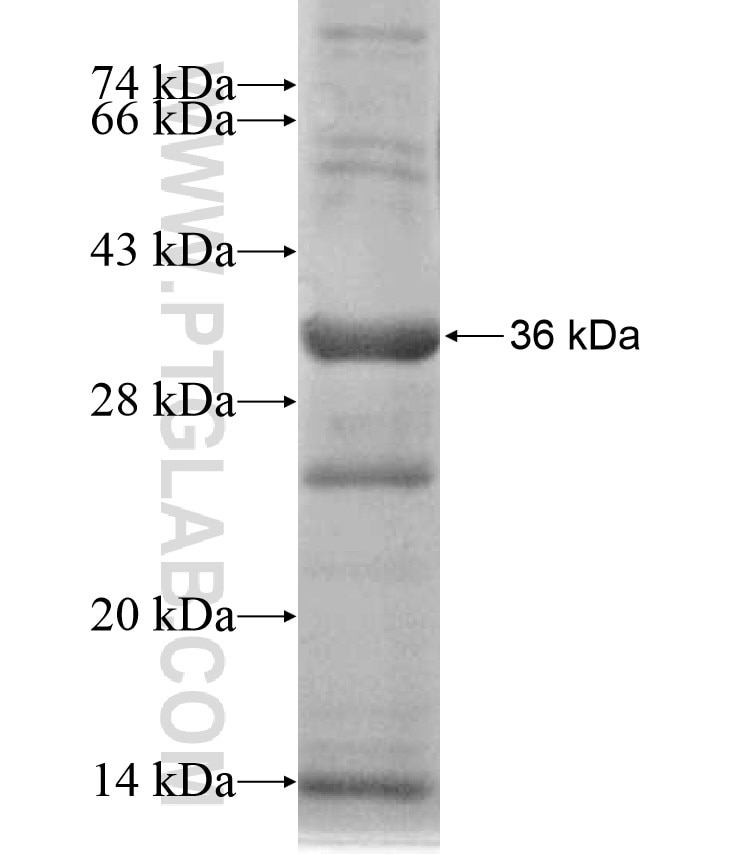 F9 fusion protein Ag17198 SDS-PAGE F9 fusion protein Ag17198 SDS-PAGE