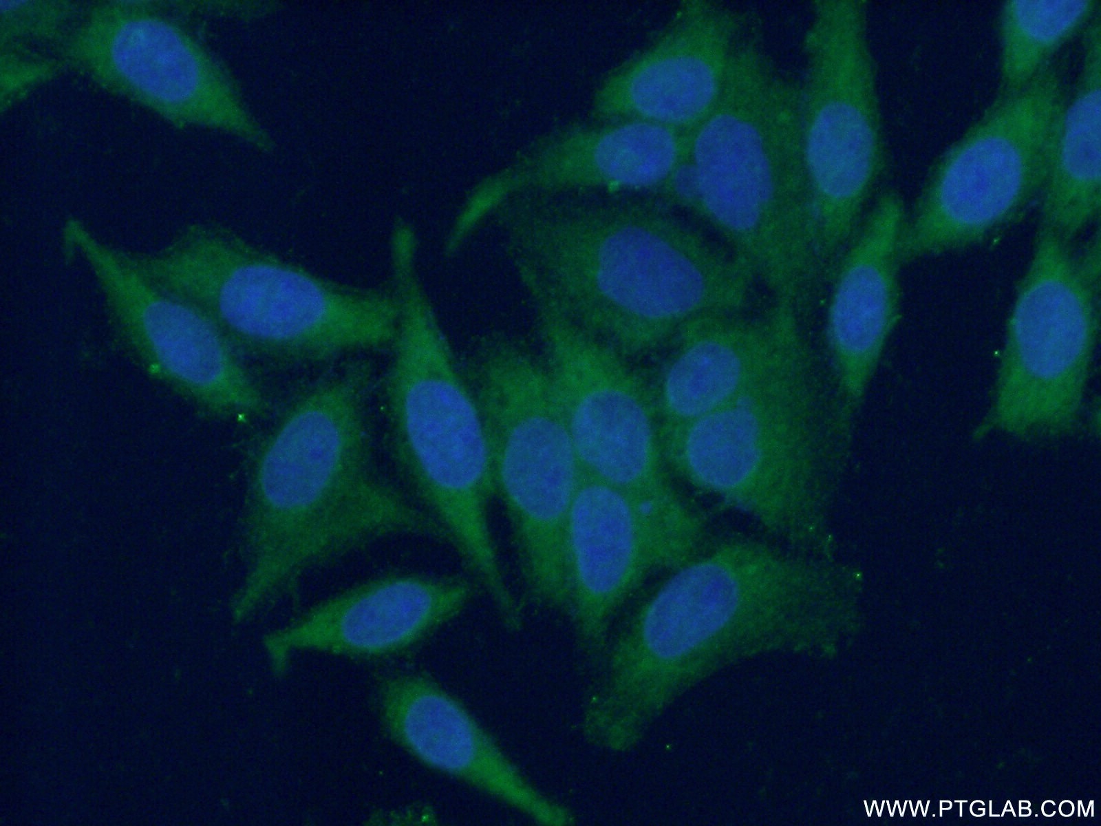 Immunofluorescence (IF) / fluorescent staining of HeLa cells using FA2H Polyclonal antibody (15452-1-AP)