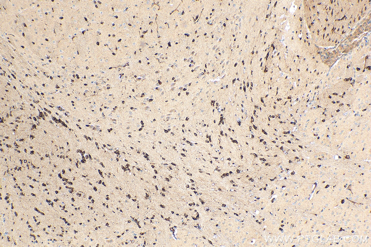 Immunohistochemistry (IHC) staining of mouse brain tissue using FA2H Polyclonal antibody (15452-1-AP)