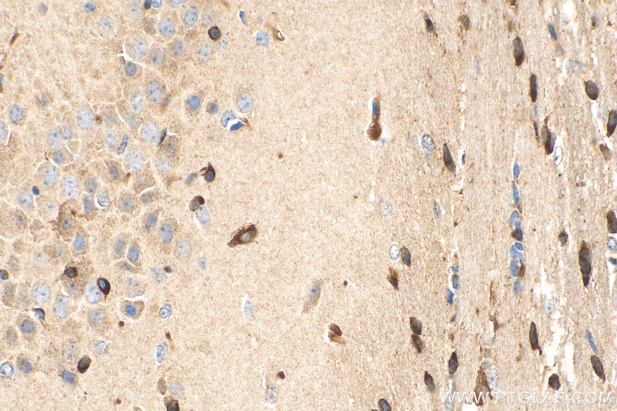 Immunohistochemistry (IHC) staining of mouse brain tissue using FA2H Polyclonal antibody (15452-1-AP)