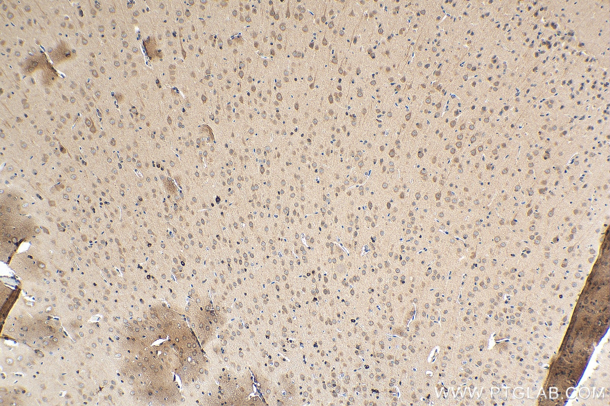 Immunohistochemistry (IHC) staining of rat brain tissue using FA2H Polyclonal antibody (15452-1-AP)