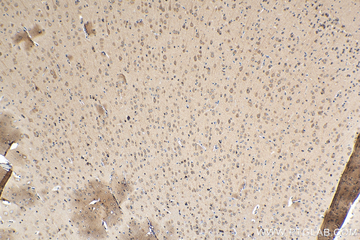 IHC staining of rat brain using 15452-1-AP