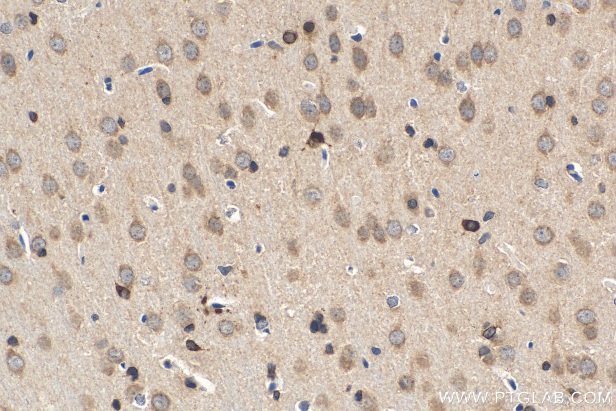 Immunohistochemistry (IHC) staining of rat brain tissue using FA2H Polyclonal antibody (15452-1-AP)