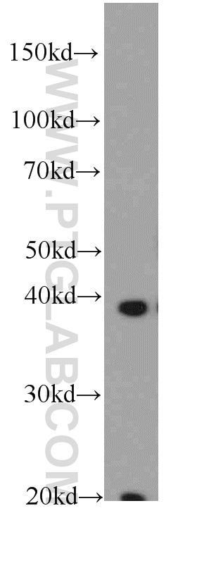 Western Blot (WB) analysis of human stomach tissue using FA2H Polyclonal antibody (15452-1-AP)