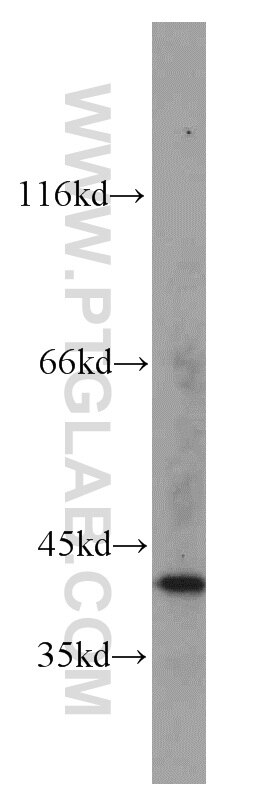 Western Blot (WB) analysis of human brain tissue using FA2H Polyclonal antibody (15452-1-AP)