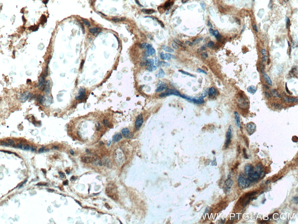 Immunohistochemistry (IHC) staining of human placenta tissue using FAAH Polyclonal antibody (17909-1-AP)