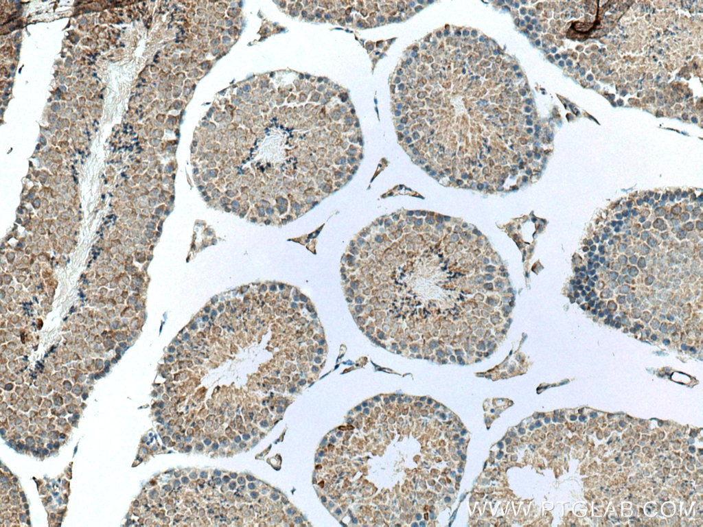 Immunohistochemistry (IHC) staining of mouse testis tissue using FAAH Polyclonal antibody (17909-1-AP)