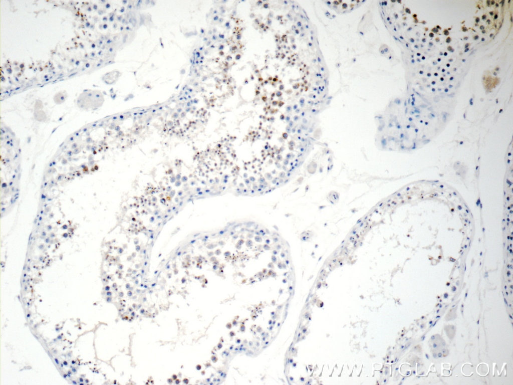 Immunohistochemistry (IHC) staining of human testis tissue using FAAH Polyclonal antibody (17909-1-AP)