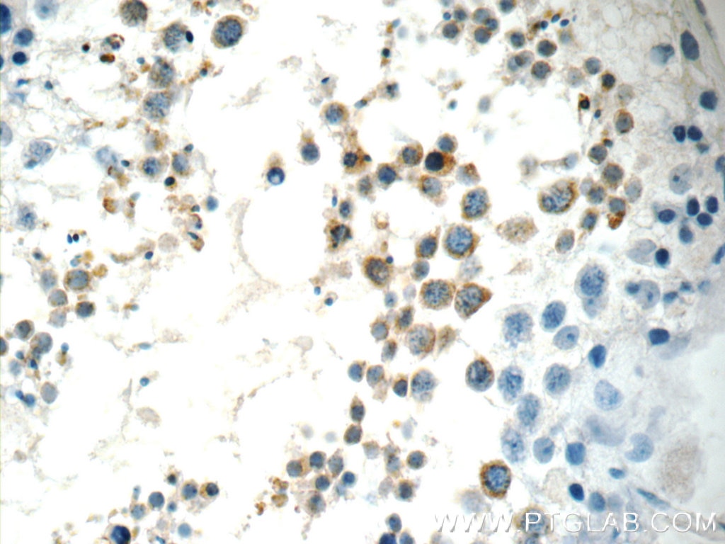 Immunohistochemistry (IHC) staining of human testis tissue using FAAH Polyclonal antibody (17909-1-AP)