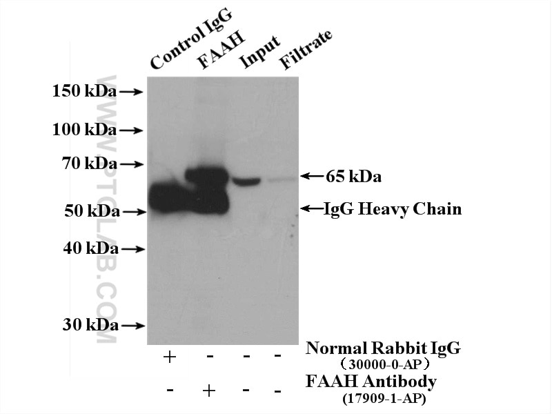 IP experiment of mouse liver using 17909-1-AP