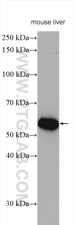 Western Blot (WB) analysis of various lysates using FAAH Polyclonal antibody (17909-1-AP)