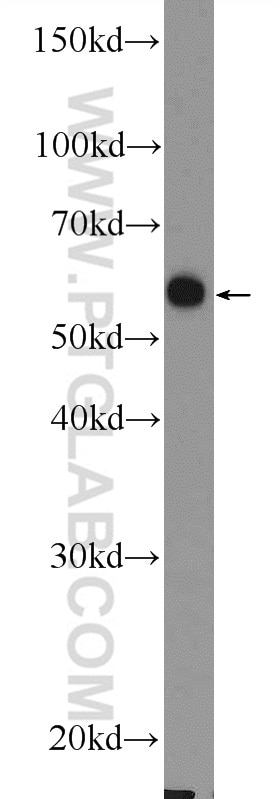 Western Blot (WB) analysis of A431 cells using FAAH Polyclonal antibody (17909-1-AP)