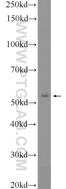 Western Blot (WB) analysis of rat testis tissue using FAAH Polyclonal antibody (17909-1-AP)