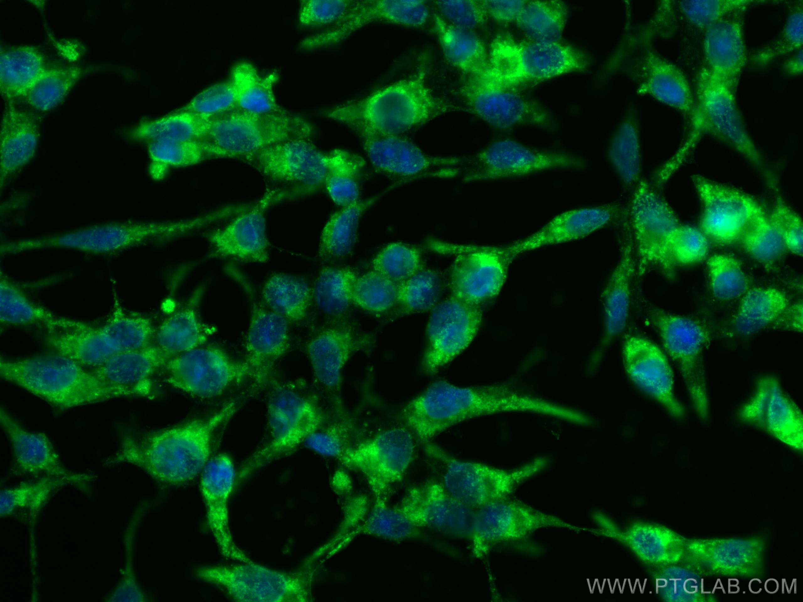 Immunofluorescence (IF) / fluorescent staining of LNCaP cells using FAAH Monoclonal antibody (67607-1-Ig)