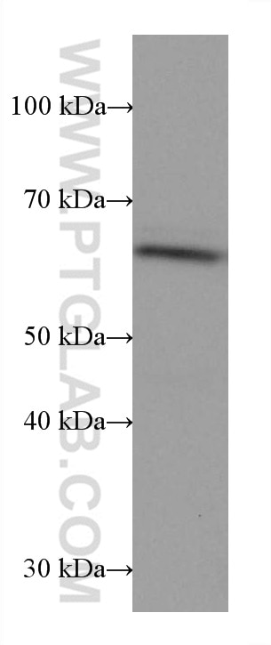 Western Blot (WB) analysis of JAR cells using FAAH Monoclonal antibody (67607-1-Ig)