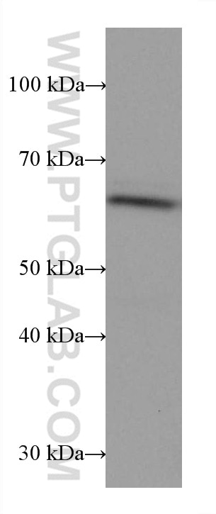 WB analysis of JAR using 67607-1-Ig