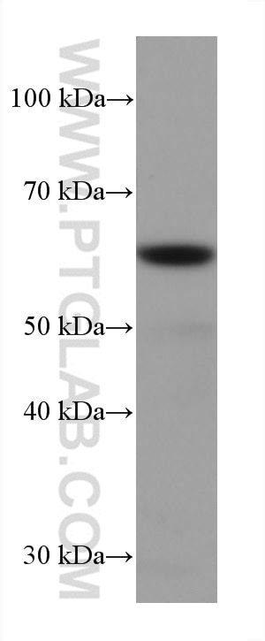 Western Blot (WB) analysis of LNCaP cells using FAAH Monoclonal antibody (67607-1-Ig)