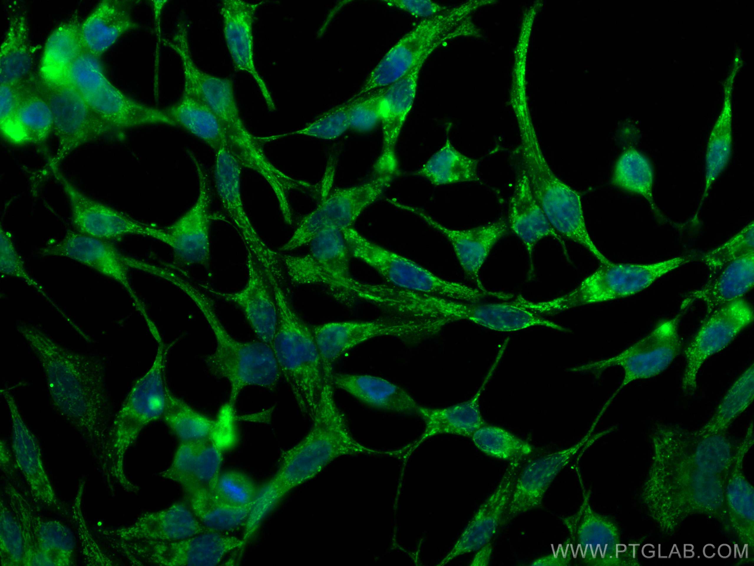 Immunofluorescence (IF) / fluorescent staining of LNCaP cells using CoraLite® Plus 488-conjugated FAAH Monoclonal anti (CL488-67607)