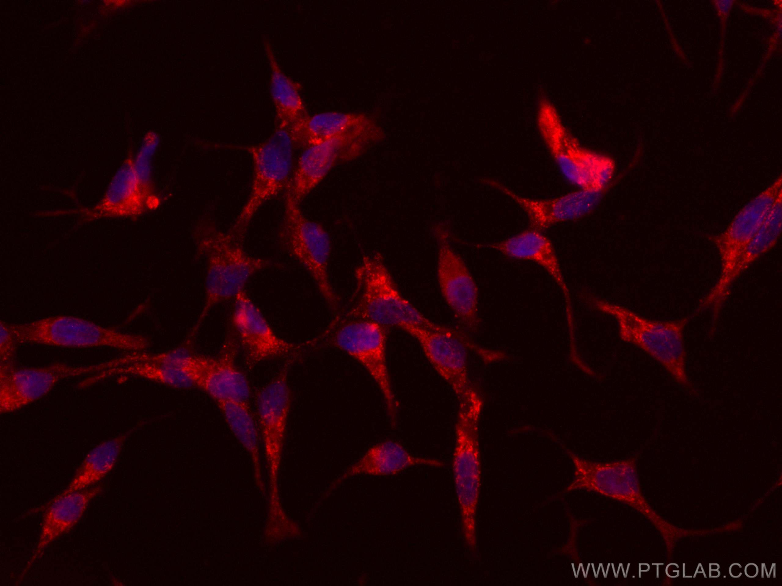 Immunofluorescence (IF) / fluorescent staining of LNCaP cells using CoraLite®594-conjugated FAAH Monoclonal antibody (CL594-67607)